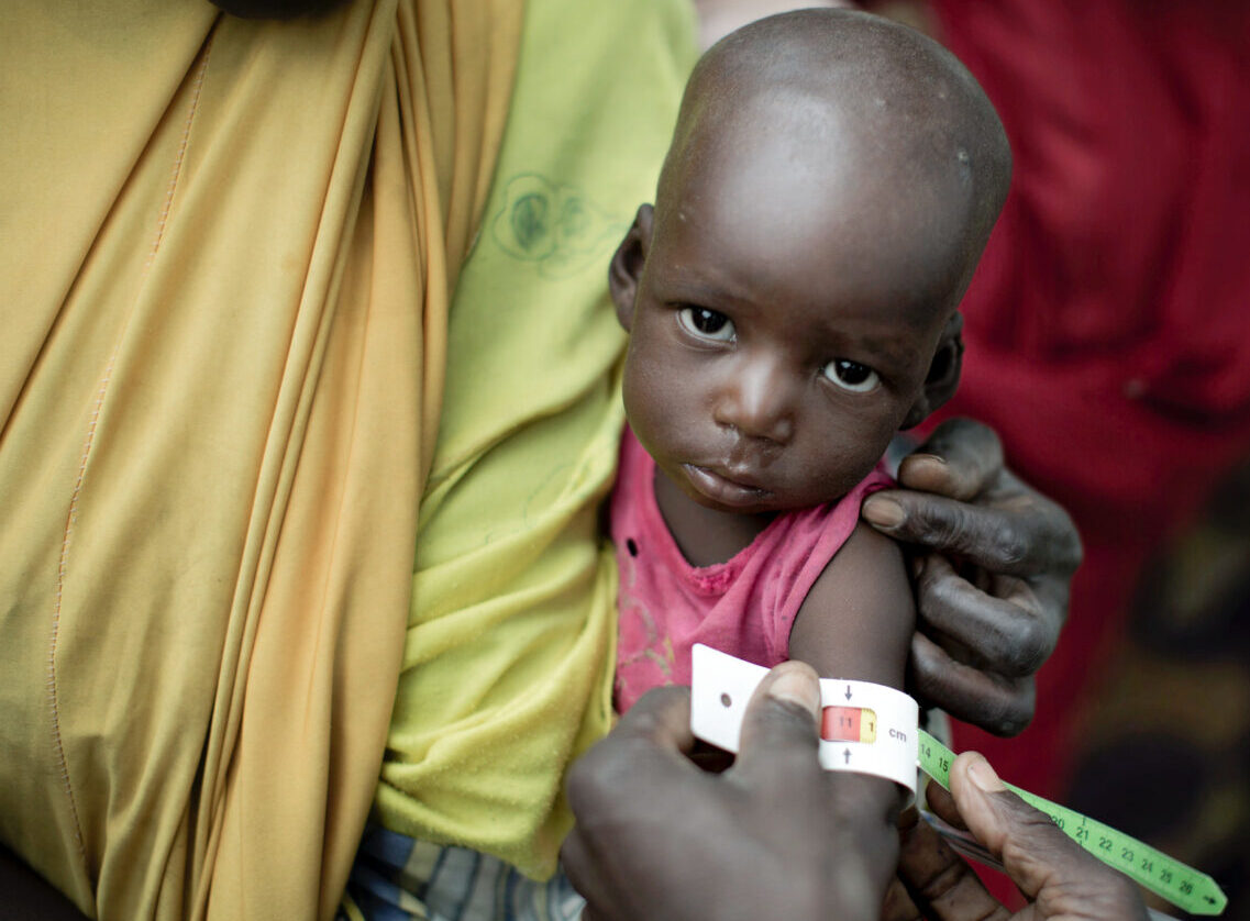 Crise alimentaire mondiale : de plus en plus de personnes meurent de la faim