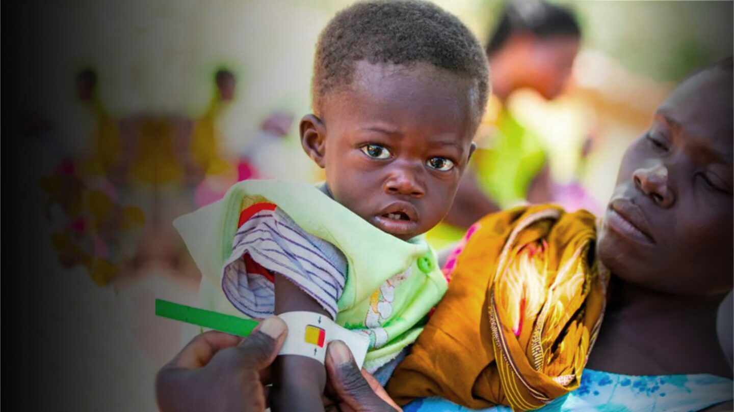 Un petit garçon victime de malnutrition soutenu par l'ONG CARE