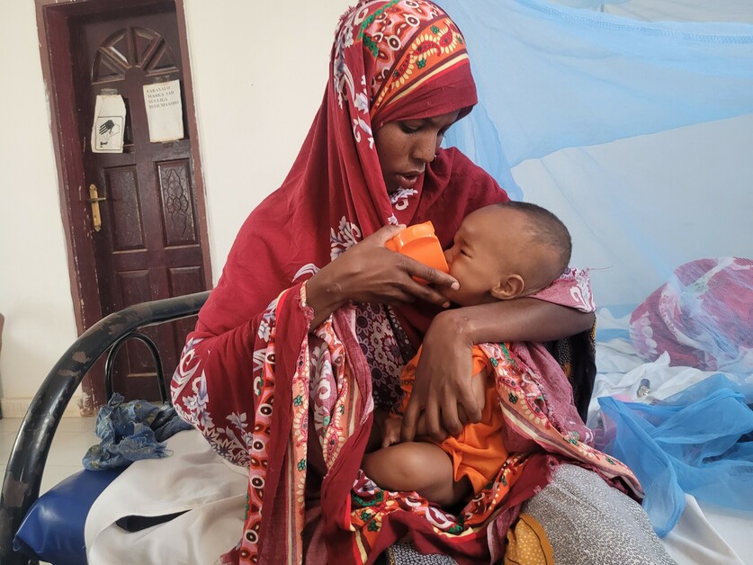 enfant souffrant de malnutrition en Somalie