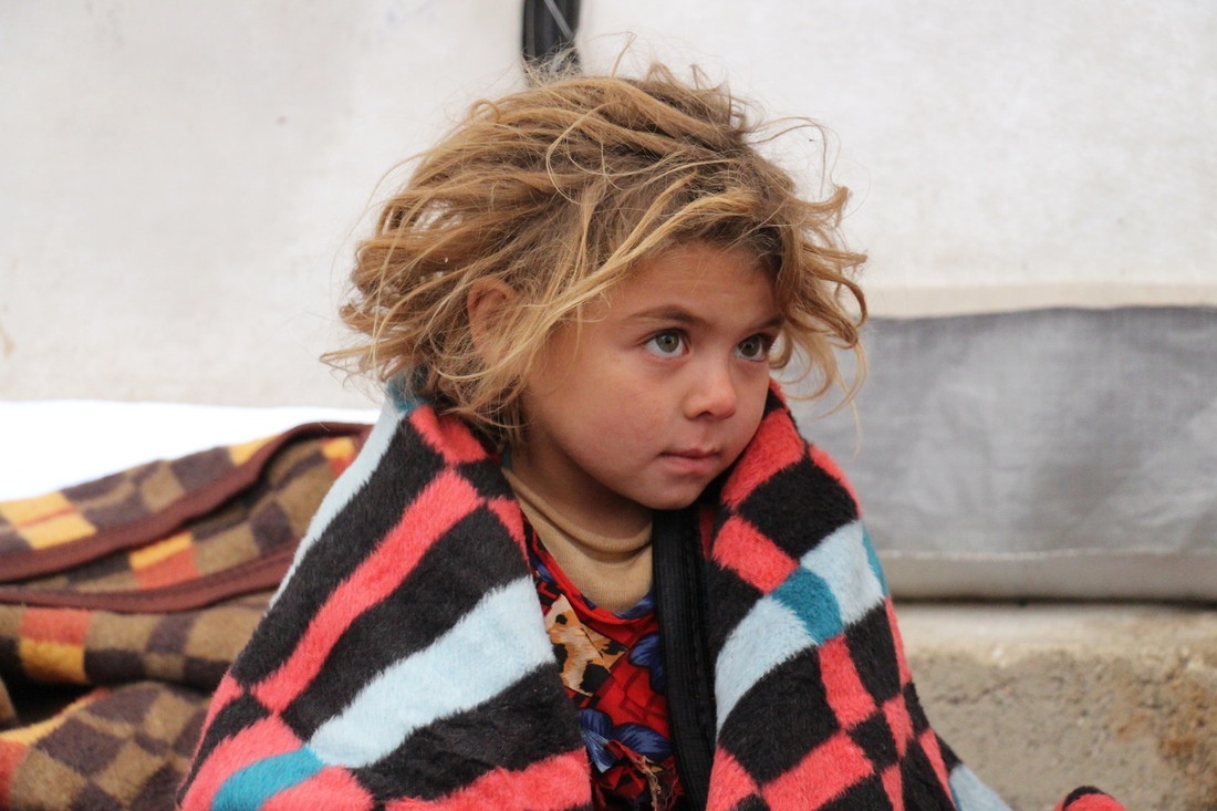 Une petite fille subit les conséquences de la guerre en Syrie