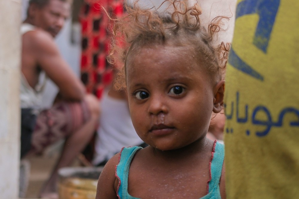 L'association CARE apporte une aide au Yémen